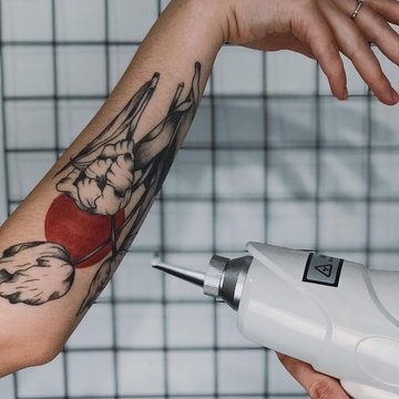 Удаление татуажа в Ирпене