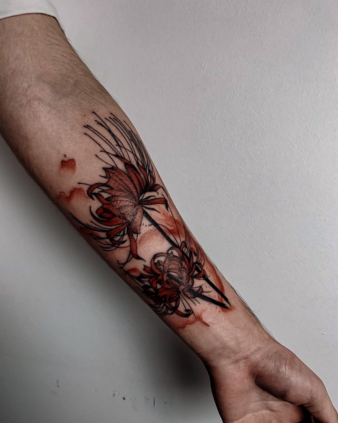 Лазерное удаление татуировок и татуажа в Виннице фото, отзывы — Лазерхауз